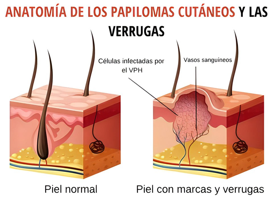 WIPEOFF™  Removedor de manchas y lunares