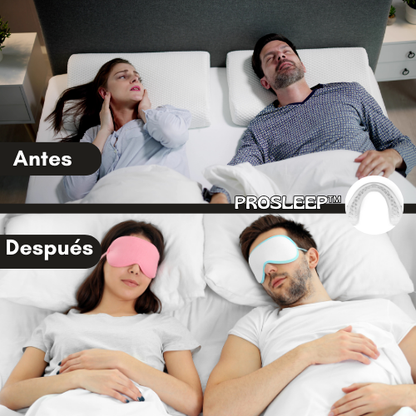 PROSLEEP™ | Protetor Bucal Anti-Ronquido