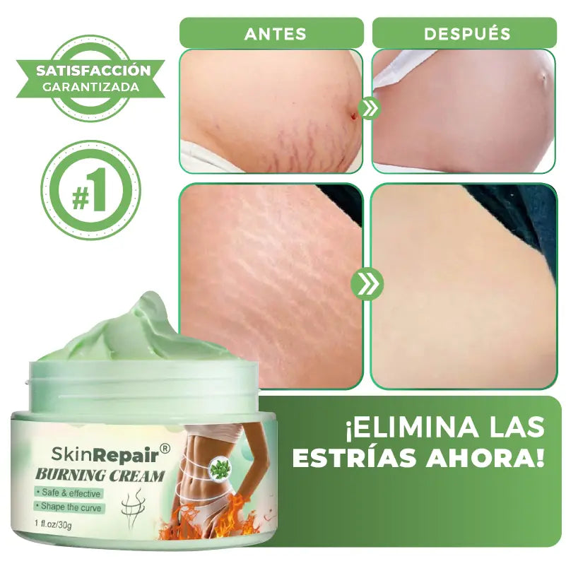 CREMA ANTI ESTRÍAS Y CELULITIS SKIN REPAIR®