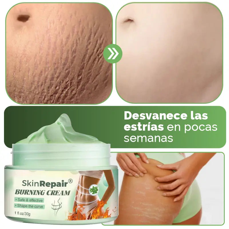 CREMA ANTI ESTRÍAS Y CELULITIS SKIN REPAIR®