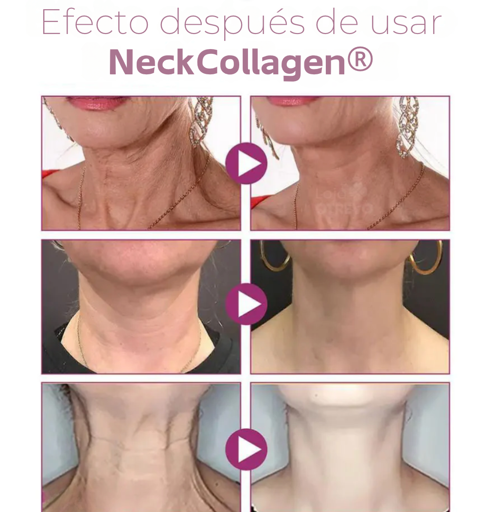 NeckCollagen® - Crema reductora de papada y arrugas