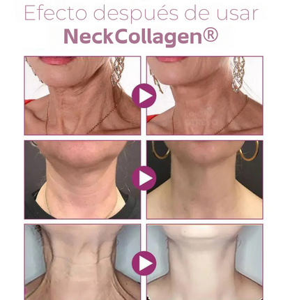 NeckCollagen® - Crema reductora de papada y arrugas