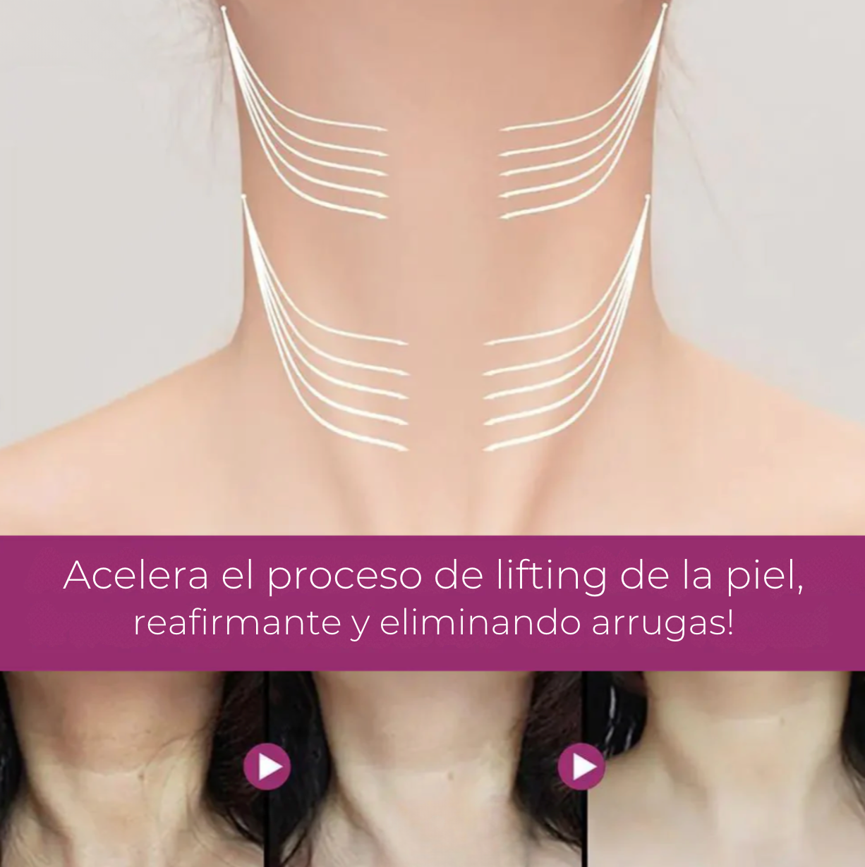 NeckCollagen® - Crema reductora de papada y arrugas