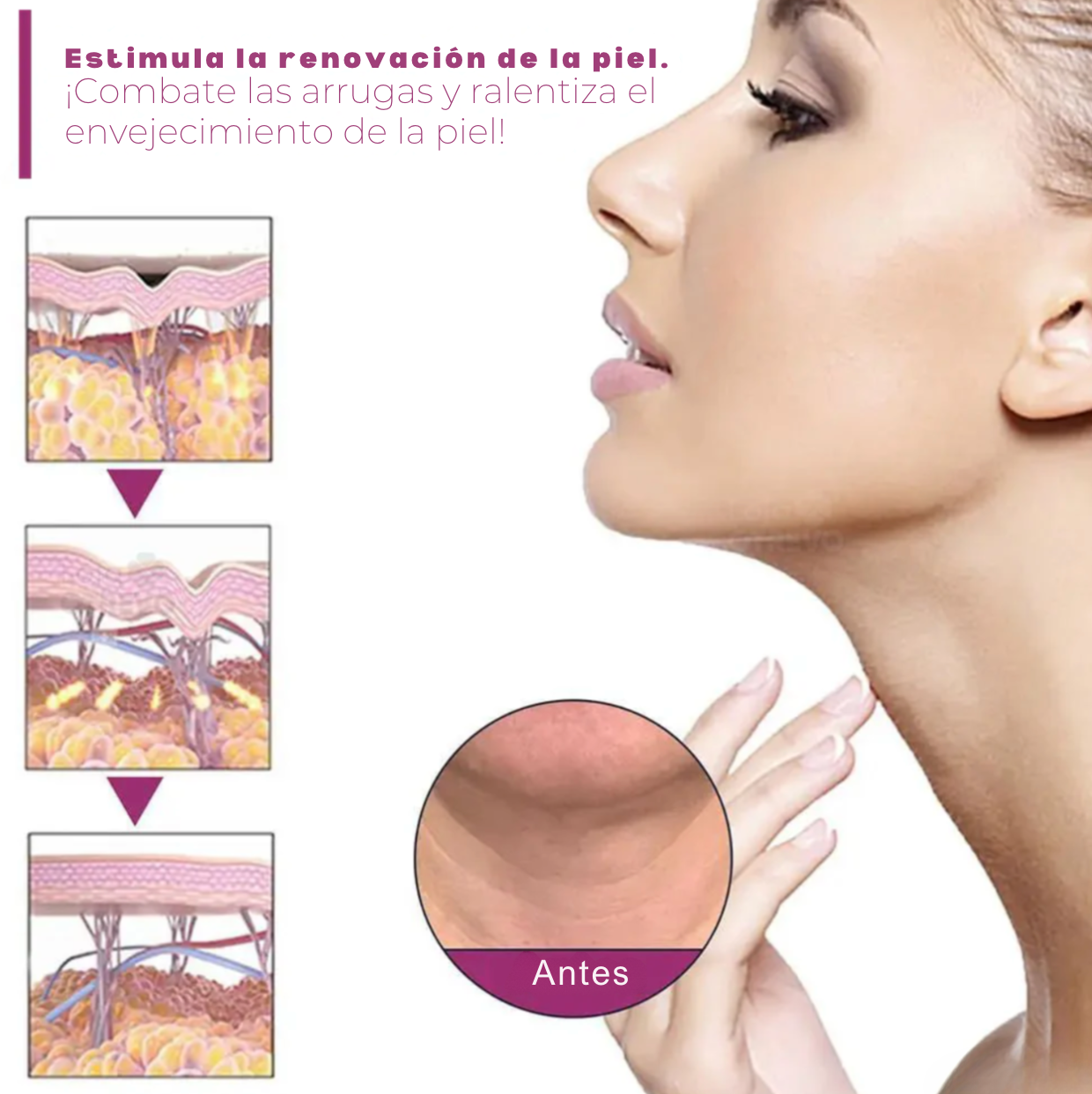 NeckCollagen® - Crema reductora de papada y arrugas