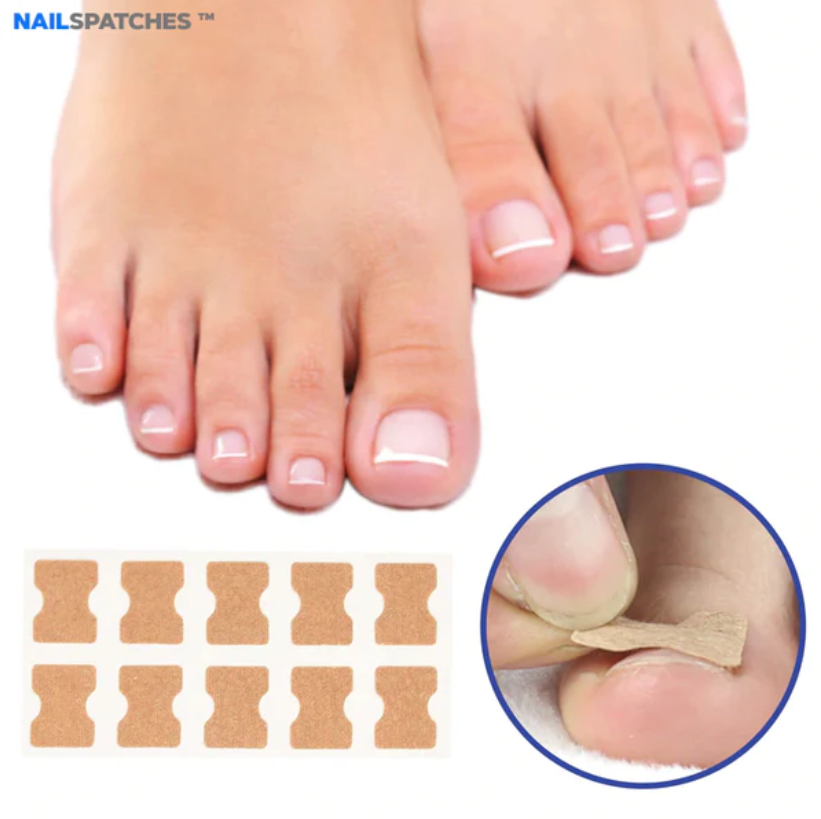 NAILSPATCHES™ CORRECTORES DE UÑAS - (FITMEDIFY)