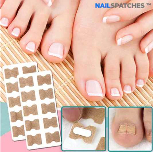 NAILSPATCHES™ CORRECTORES DE UÑAS - (FITMEDIFY)